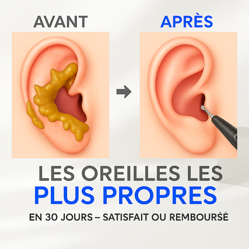 VisionEar™-Nettoyeur d’Oreilles Intelligent HD
