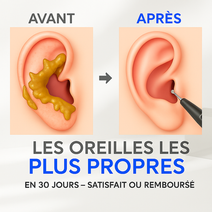 VisionEar™-Nettoyeur d’Oreilles Intelligent HD